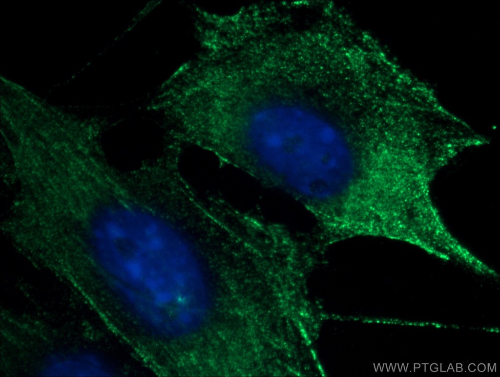 SKAP2 Monoclonal antibody