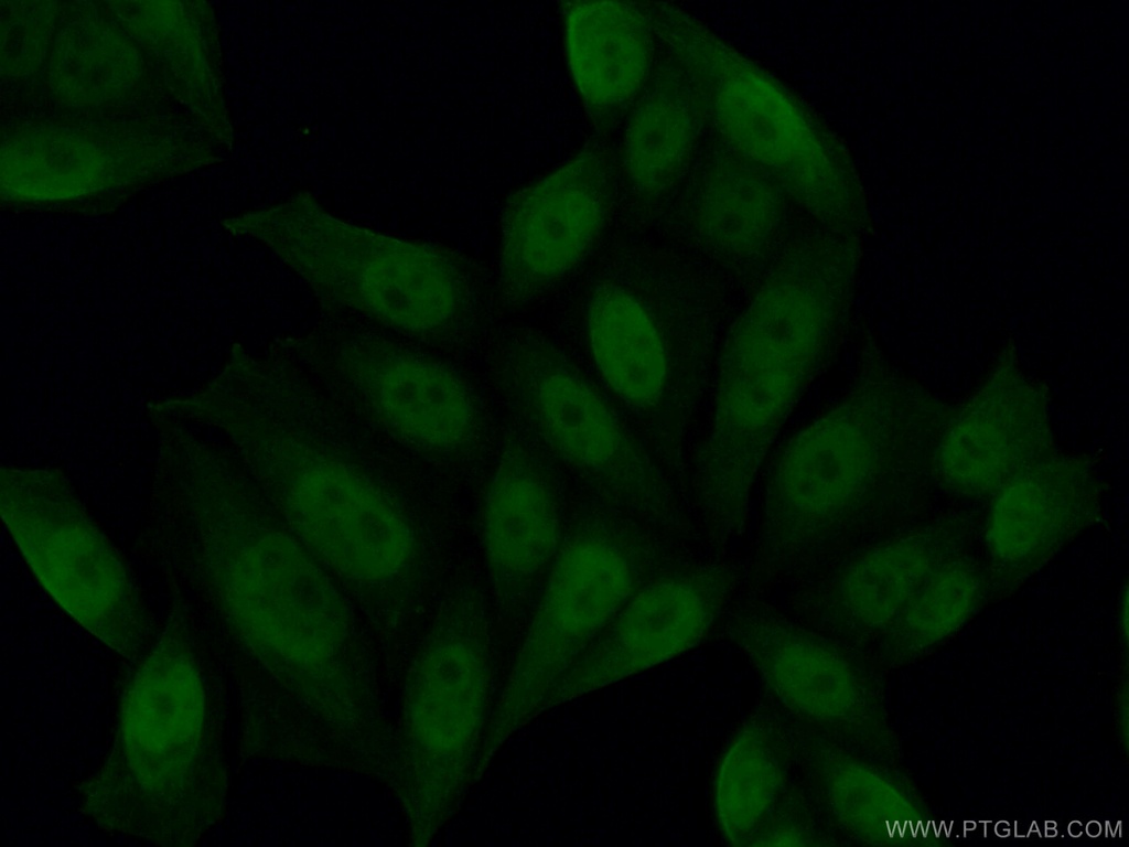 PGC1a Monoclonal antibody