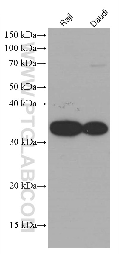 CD74 Monoclonal antibody