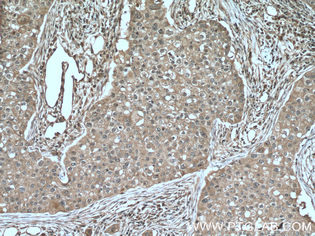 VPRBP Monoclonal antibody