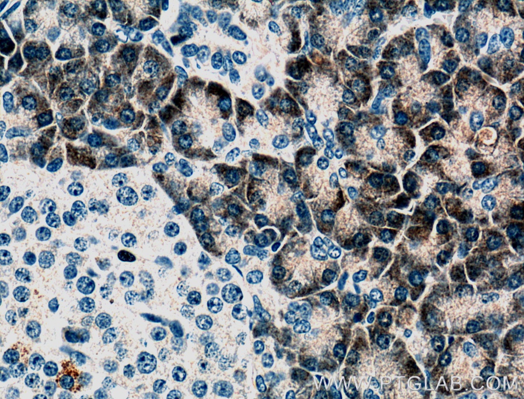 PLA2G1B Monoclonal antibody