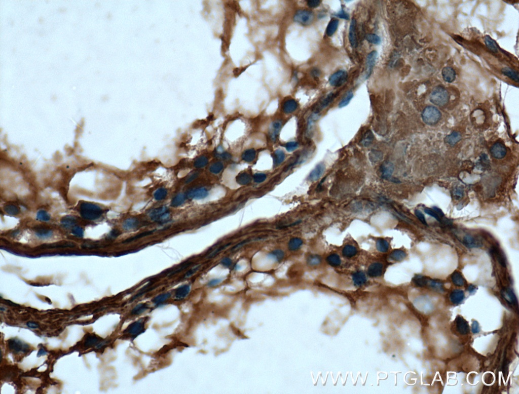 VTN Monoclonal antibody