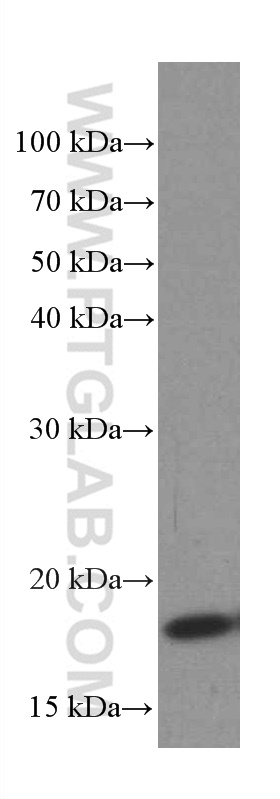 TPRKB Monoclonal antibody