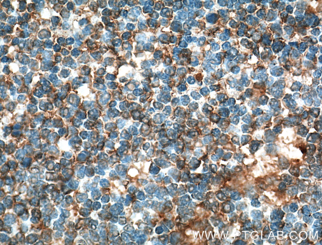 CD80/B7-1 Monoclonal antibody