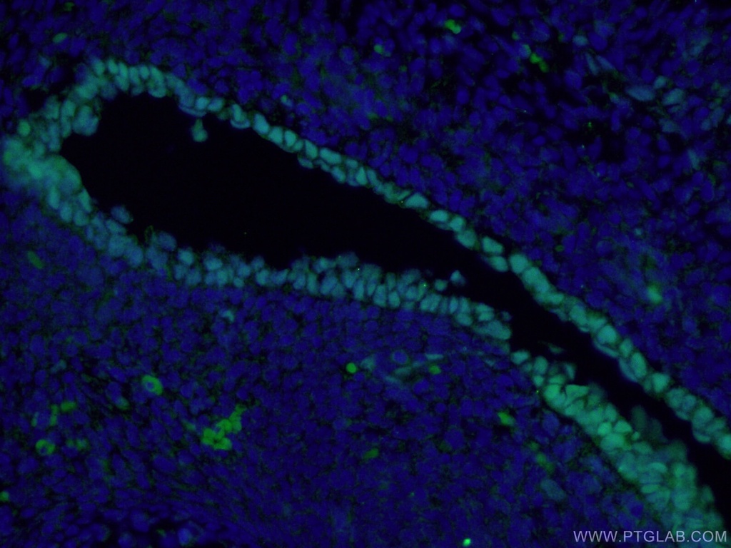 SOX2 Monoclonal antibody