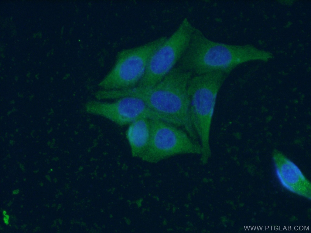 ZC3HAV1 Monoclonal antibody