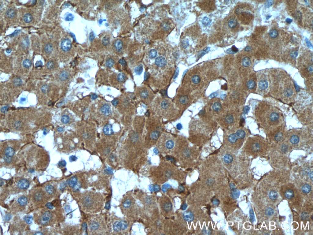 LDLR Monoclonal antibody