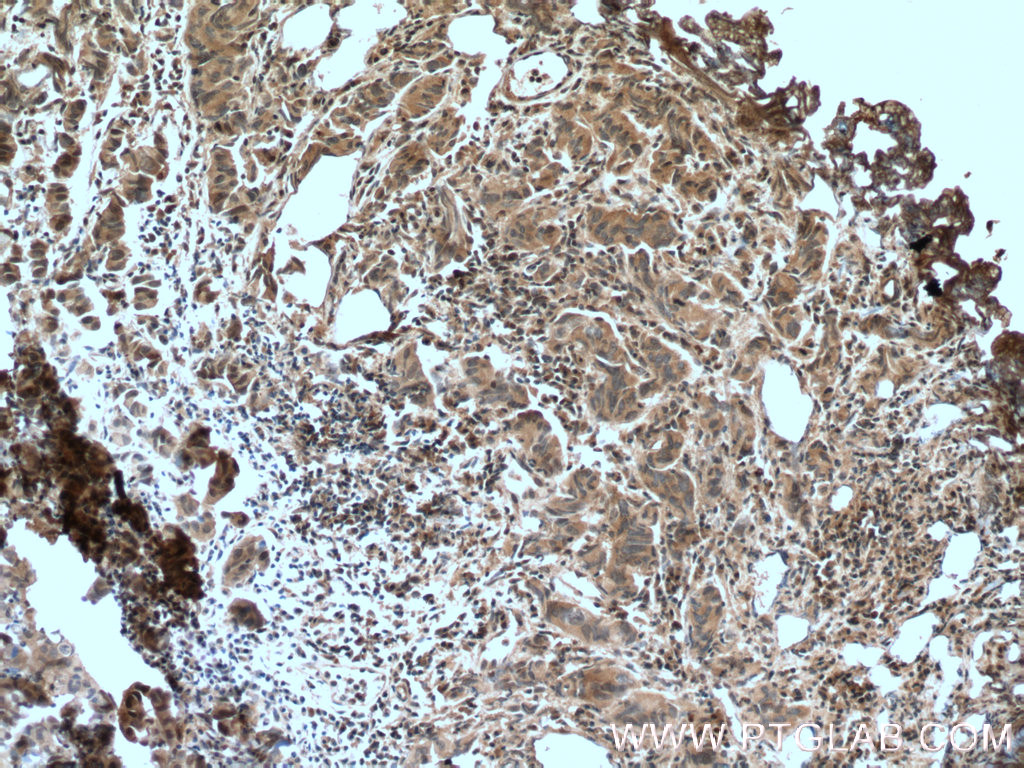 IkB Alpha Monoclonal antibody