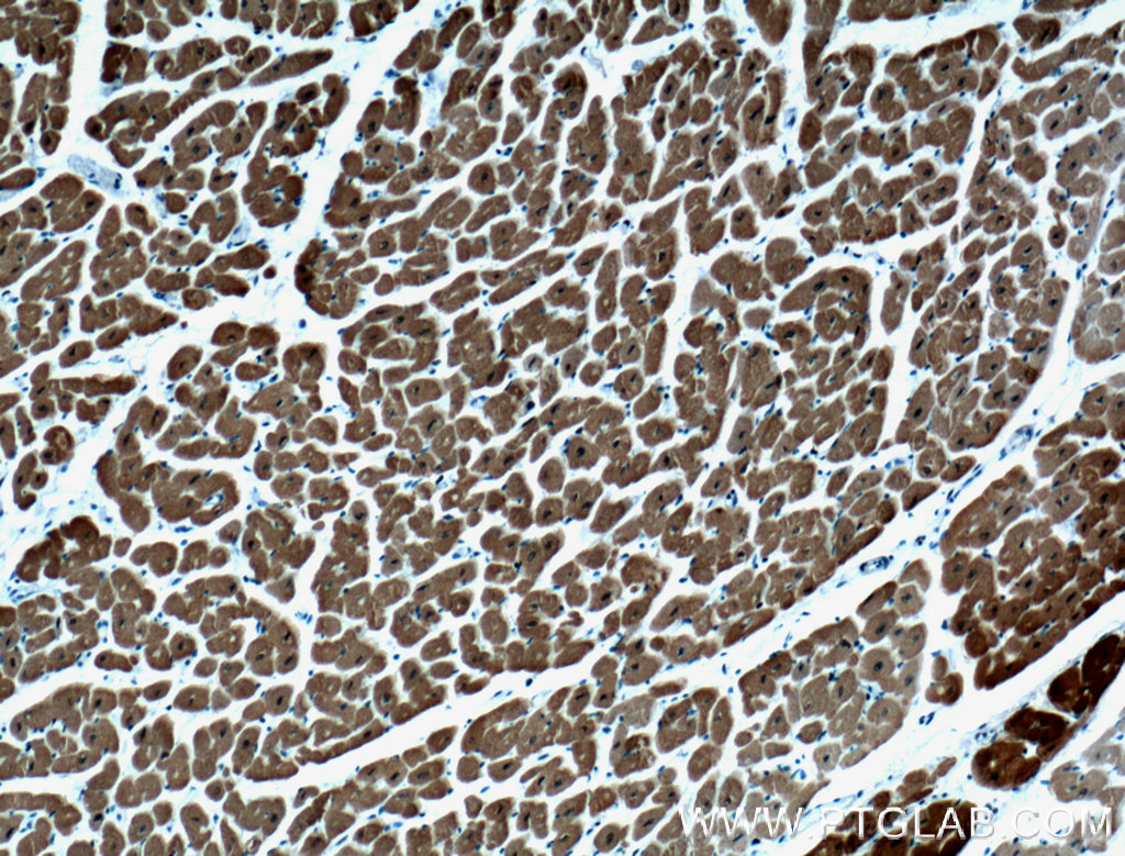 Calsequestrin 2 Monoclonal antibody