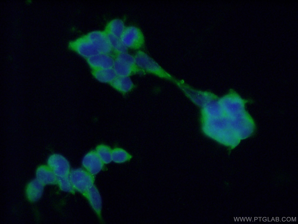 PDIA3 Monoclonal antibody