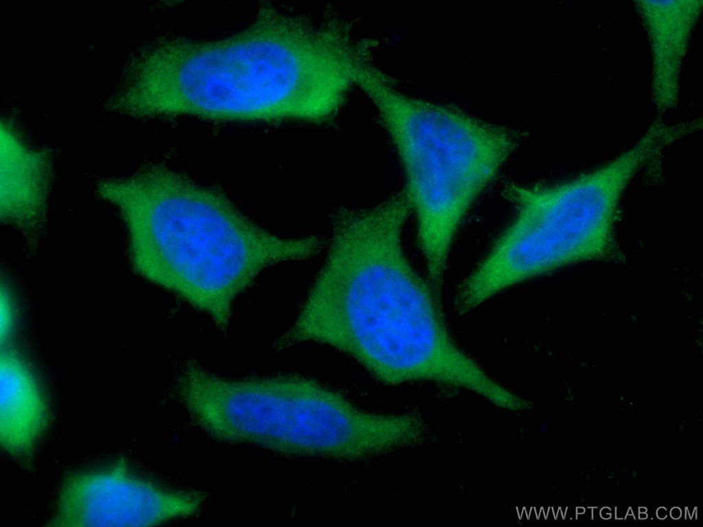 LDHB Monoclonal antibody