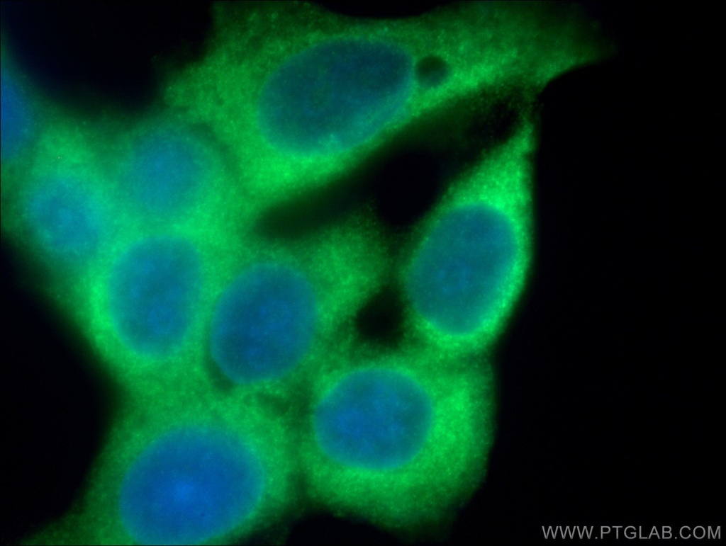 GDI1 Monoclonal antibody