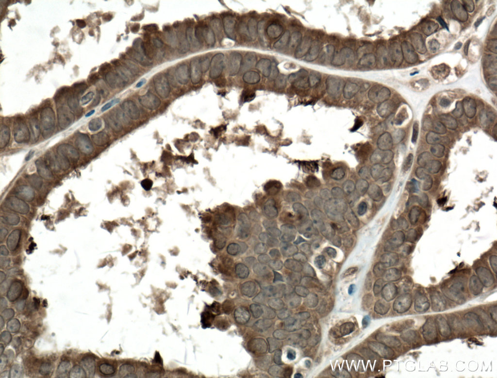 COPS2 Monoclonal antibody