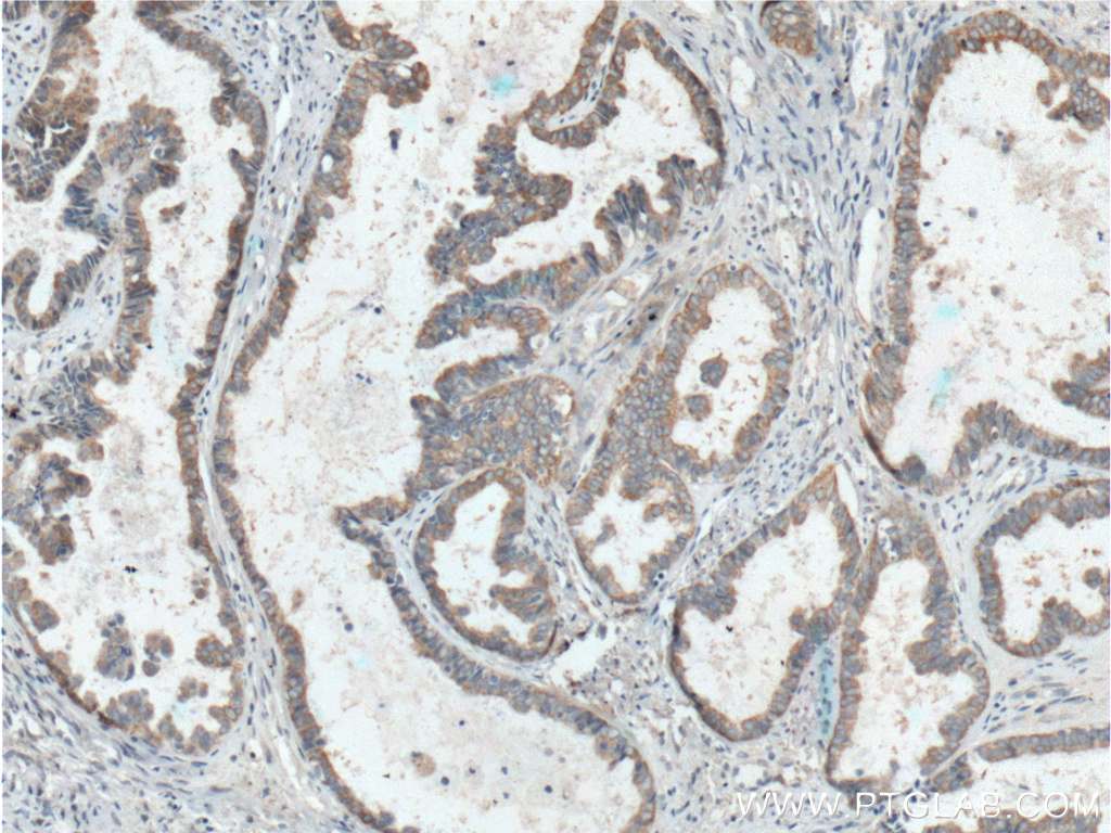 Hsc70 Monoclonal antibody