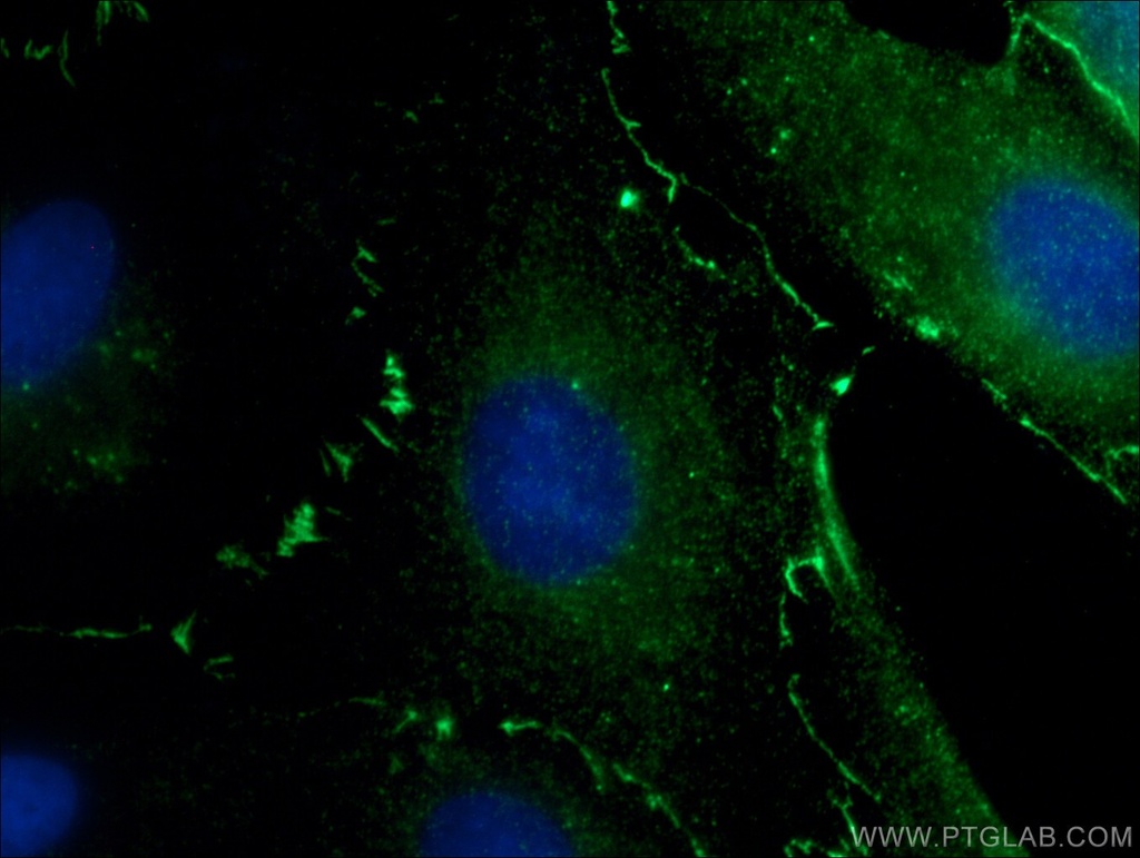 ZO-1 Monoclonal antibody