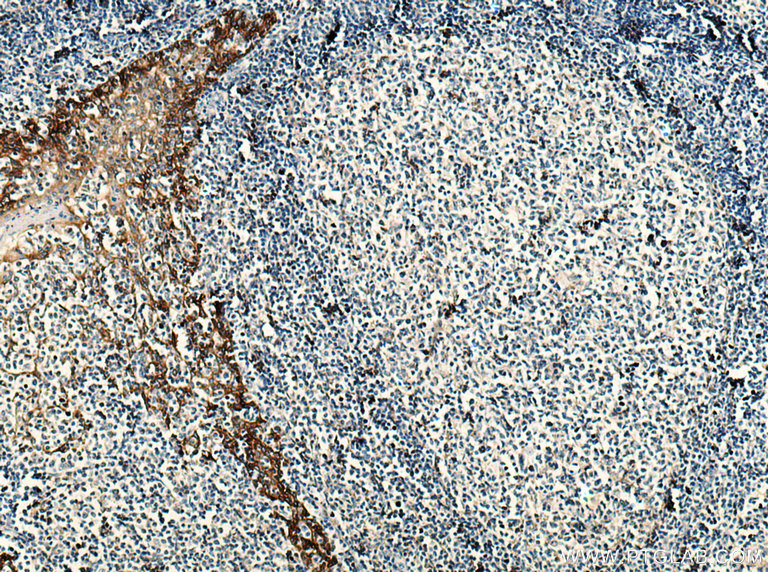 EGFR Monoclonal antibody