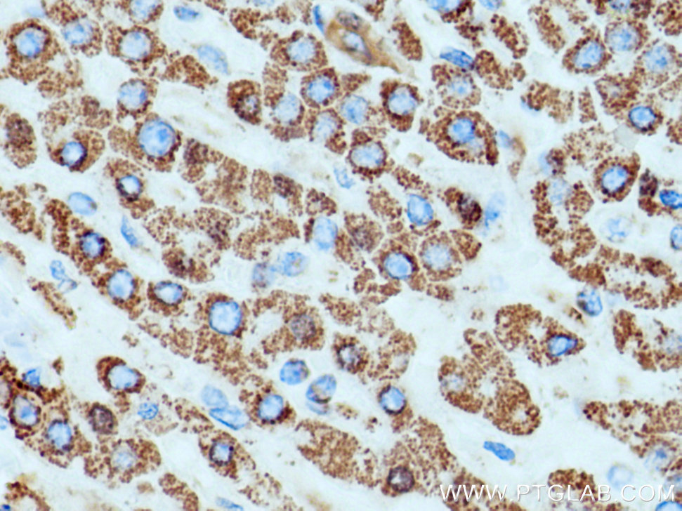SOD2 Monoclonal antibody