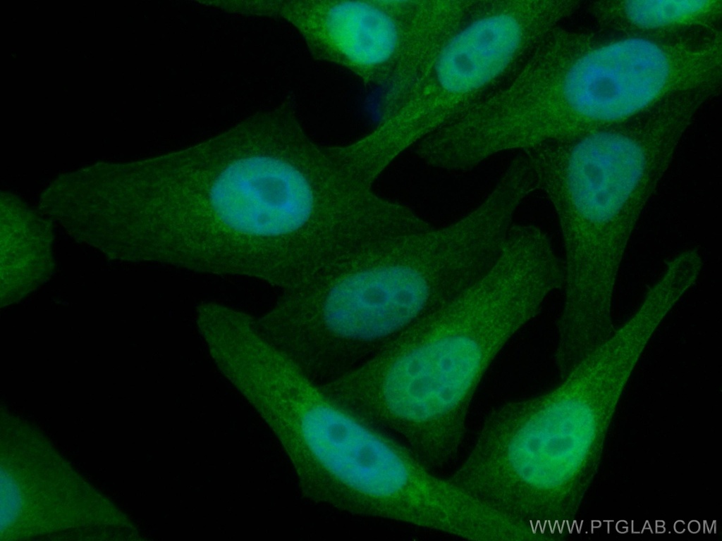 TXN Monoclonal antibody