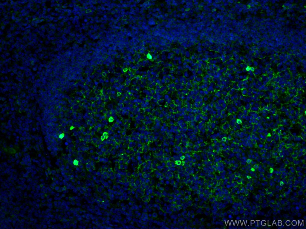 human IgM Monoclonal antibody