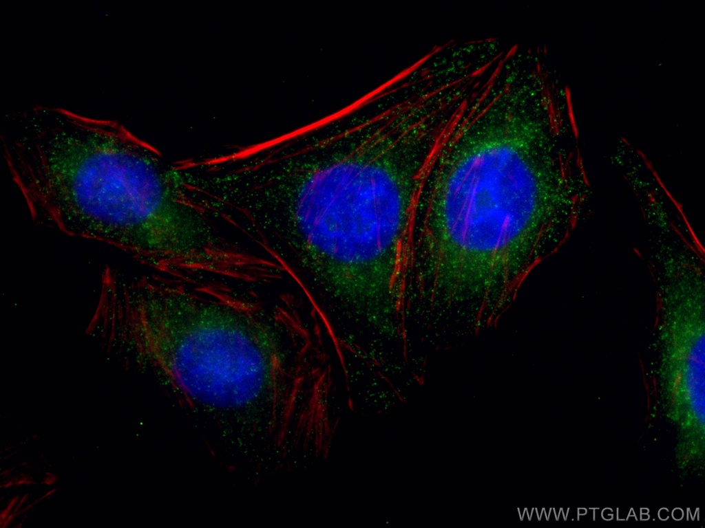 CLTC Monoclonal antibody