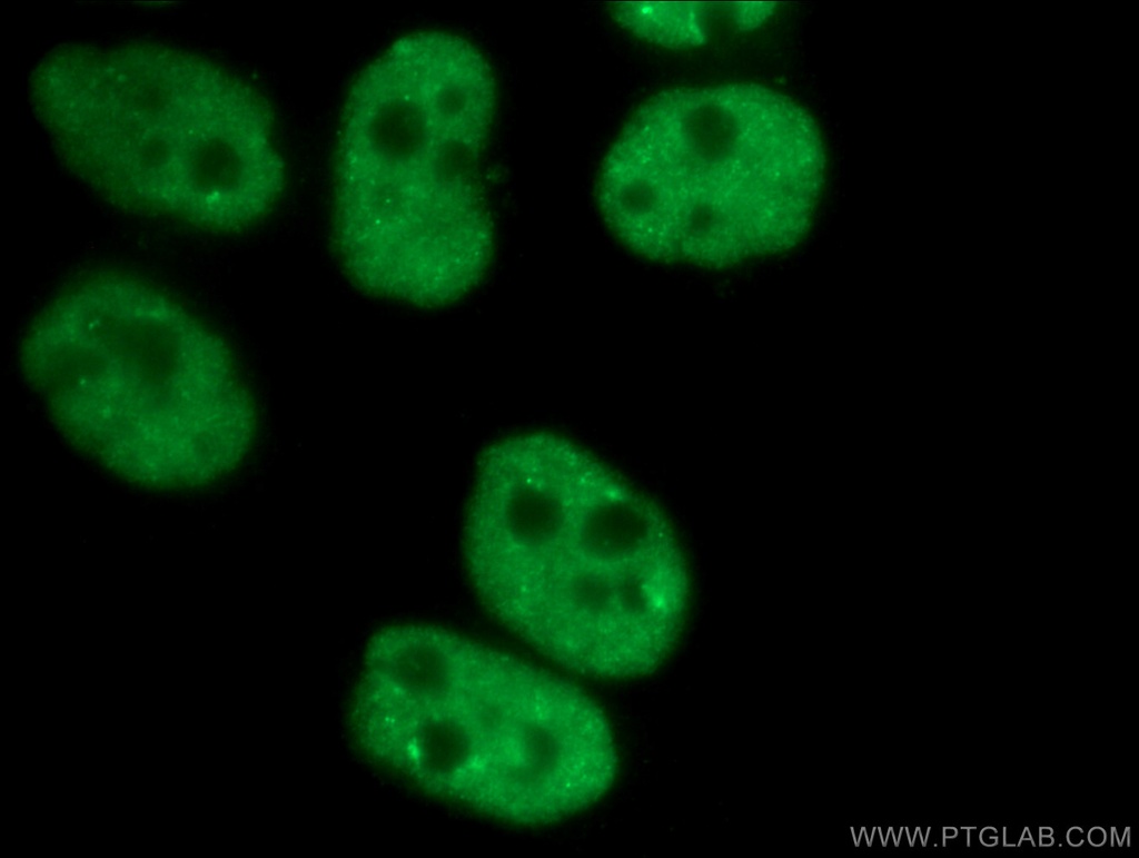 CCAR2 Monoclonal antibody