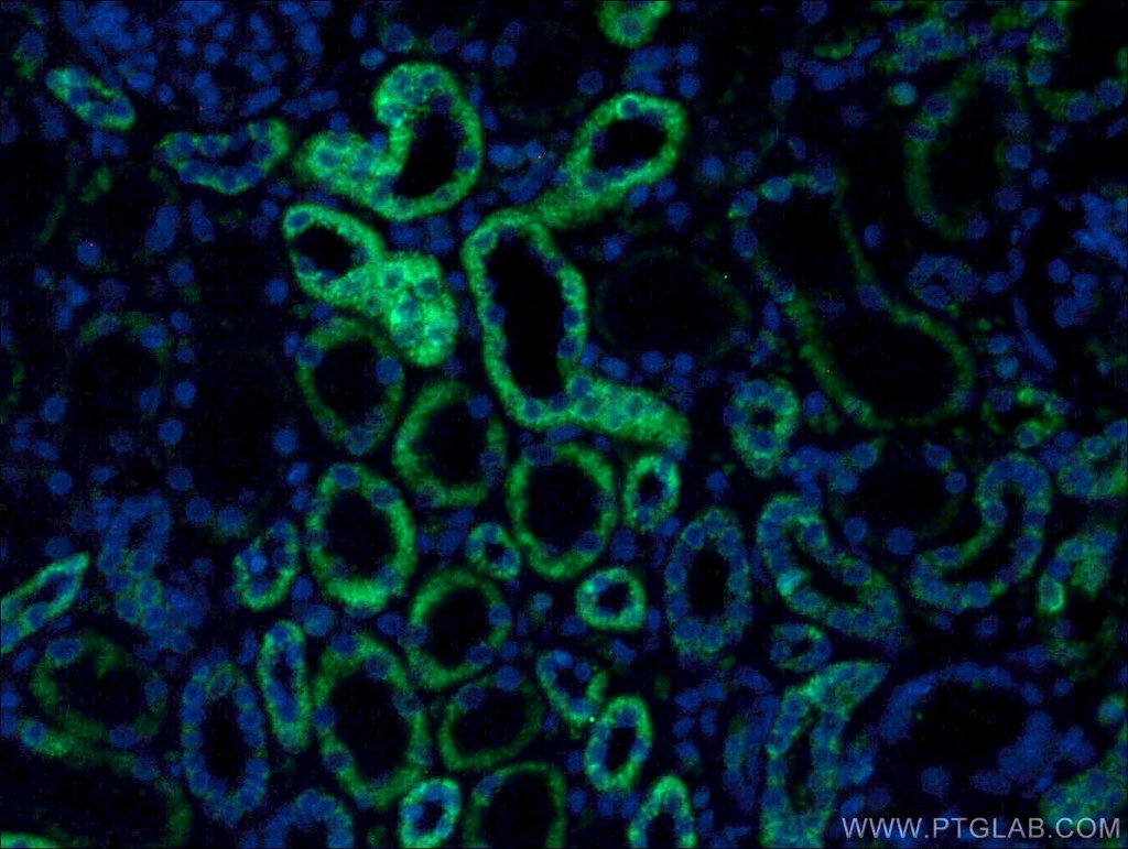 PCCB Monoclonal antibody