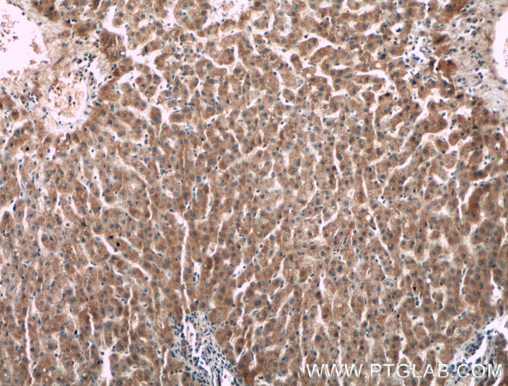 F2 Monoclonal antibody