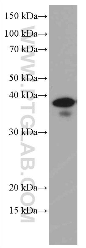 ING2 Monoclonal antibody