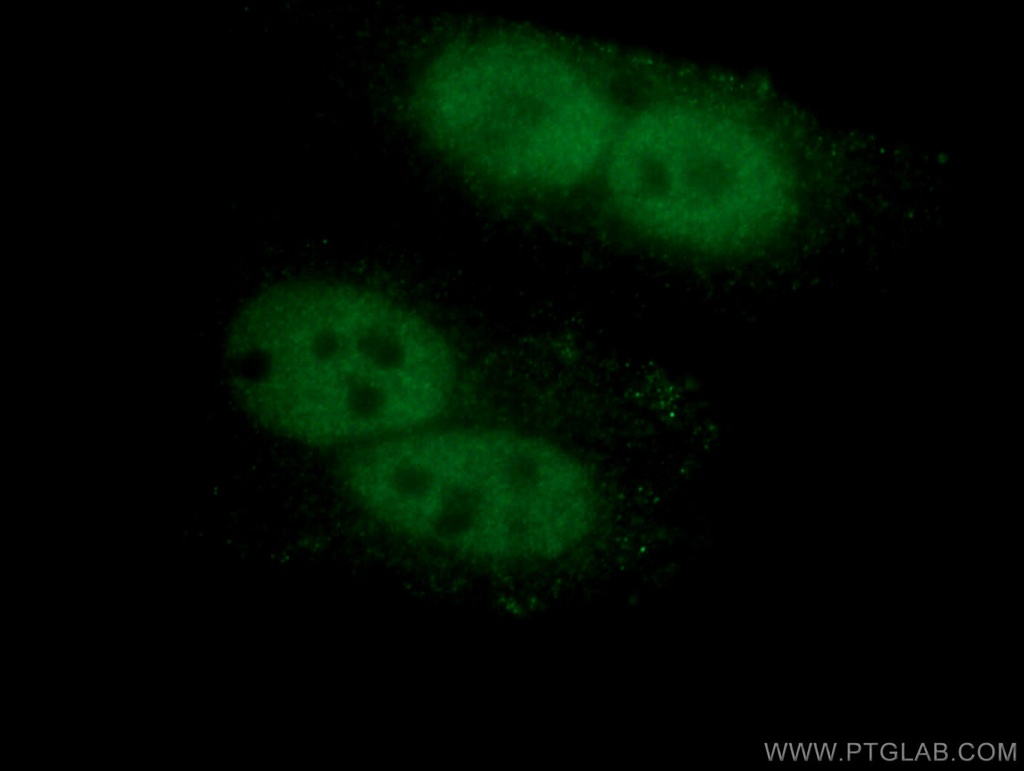 HMGB1 Monoclonal antibody