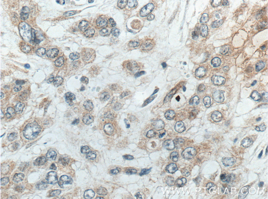 ACOT9 Monoclonal antibody