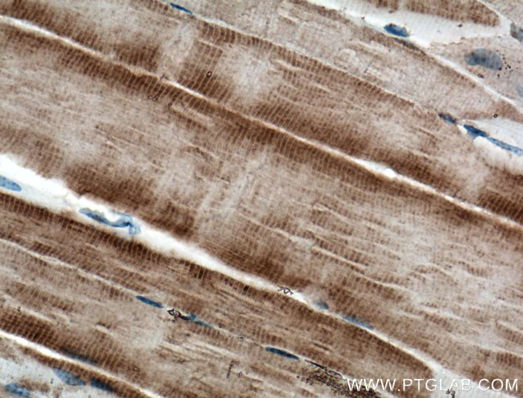 RYR1 Monoclonal antibody
