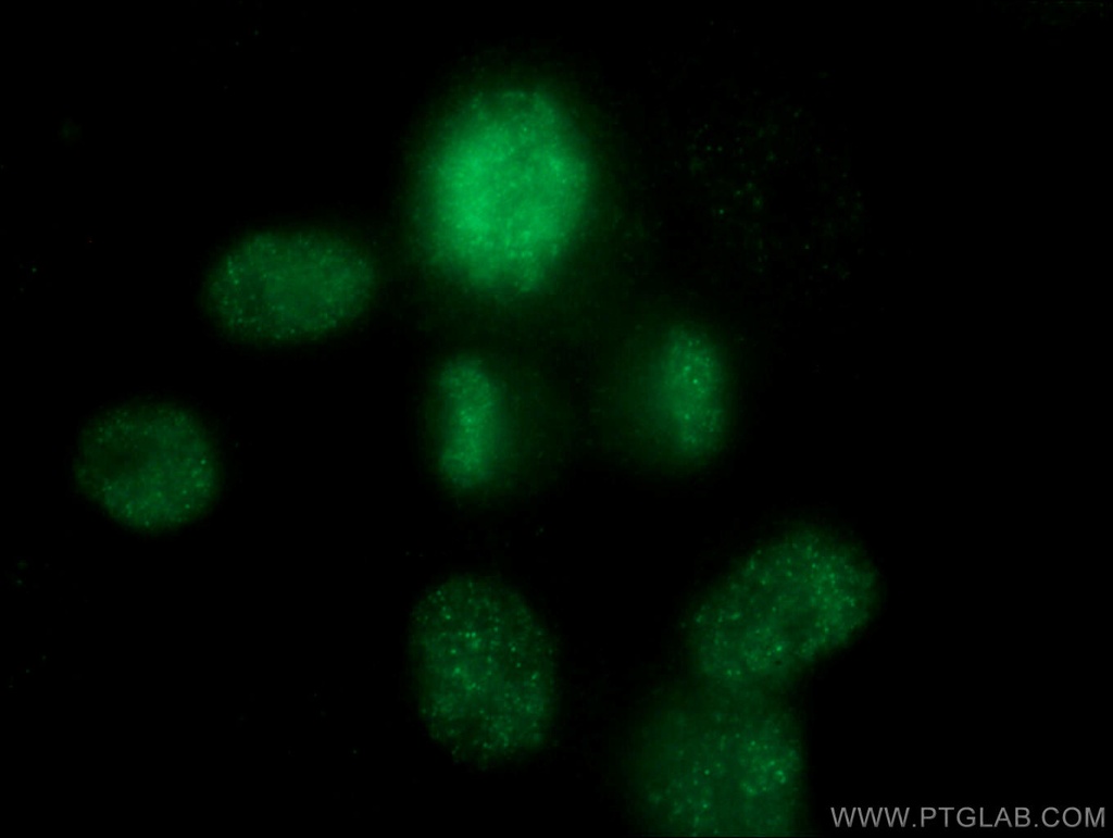 TOP2A Monoclonal antibody