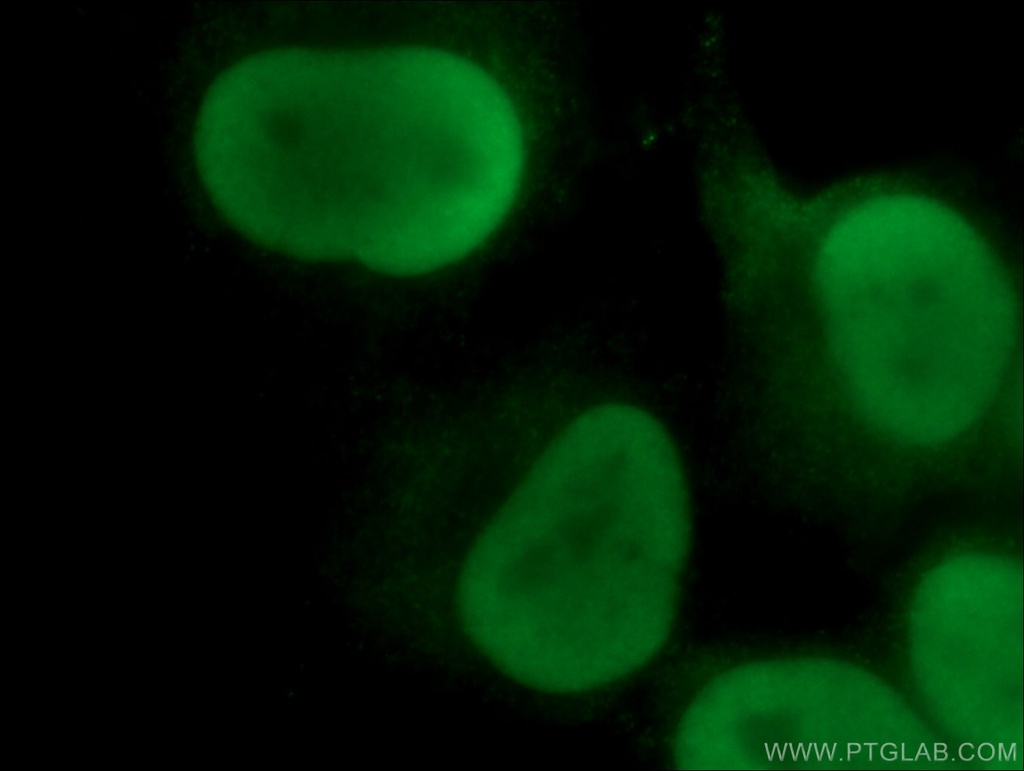 XRCC5 Monoclonal antibody