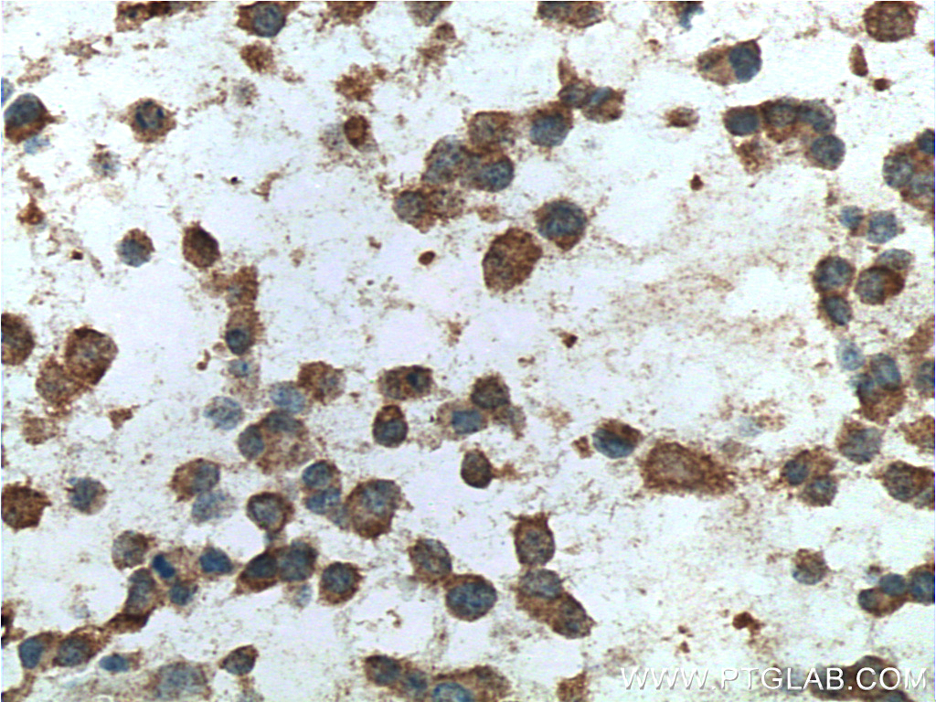 FMR1 Monoclonal antibody