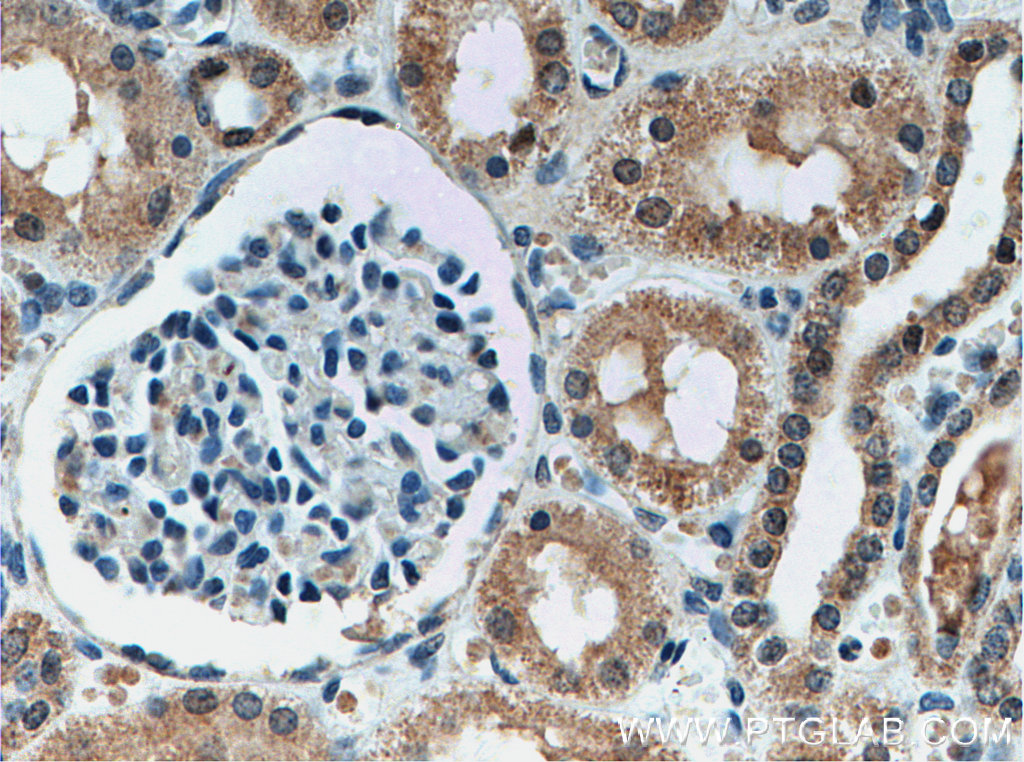 YME1L1 Monoclonal antibody