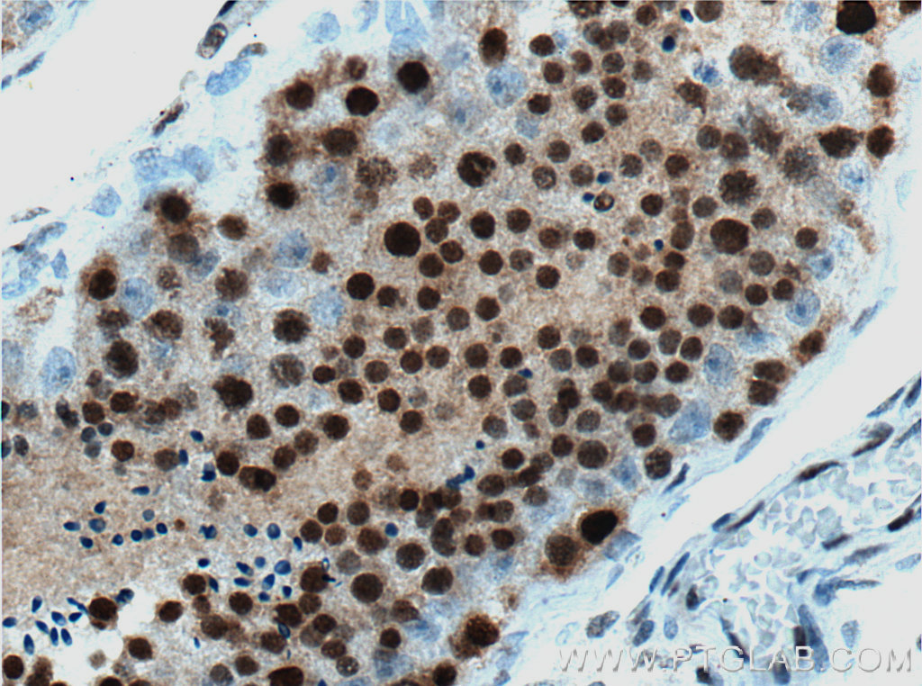 NHEJ1 Monoclonal antibody