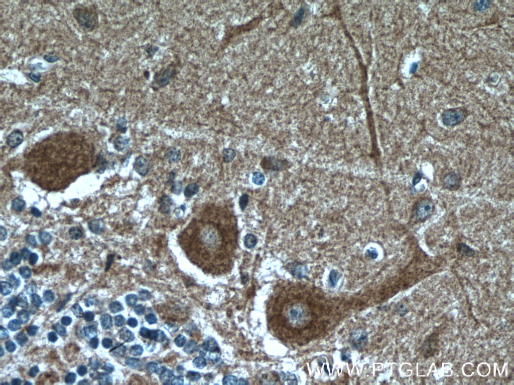Huntingtin Monoclonal antibody