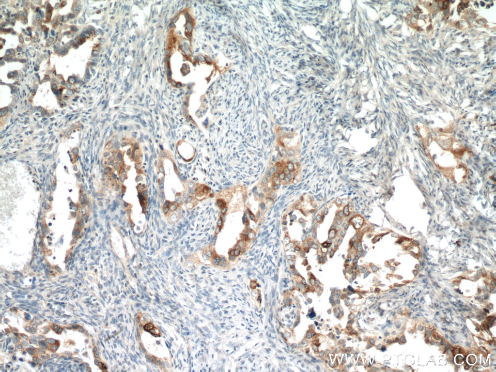 HE4 Monoclonal antibody