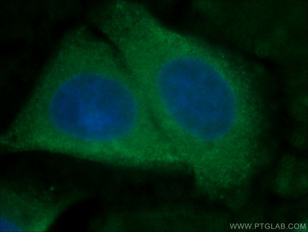 ATF6 Monoclonal antibody