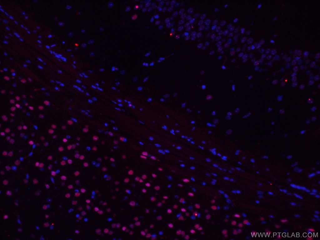 TBR1 Monoclonal antibody