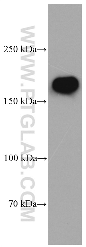 NMDAR2B/GRIN2B Monoclonal antibody