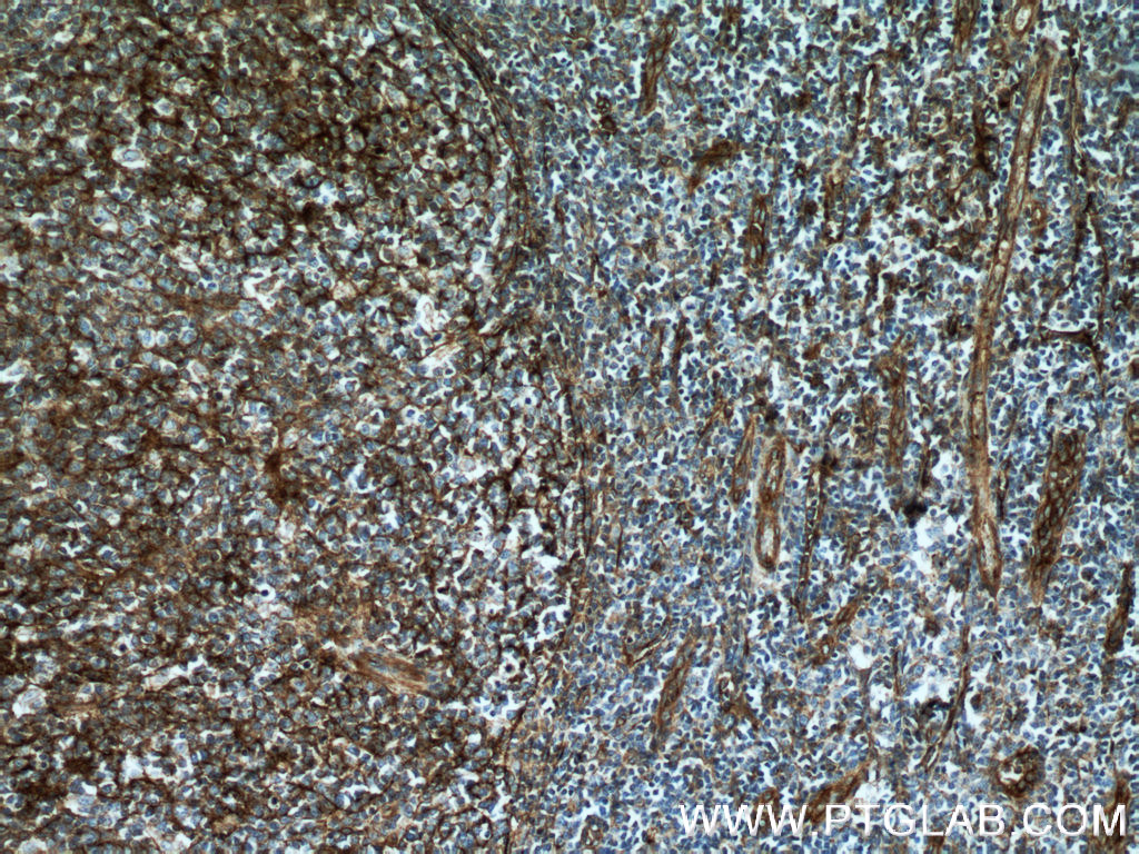 CD151 Monoclonal antibody