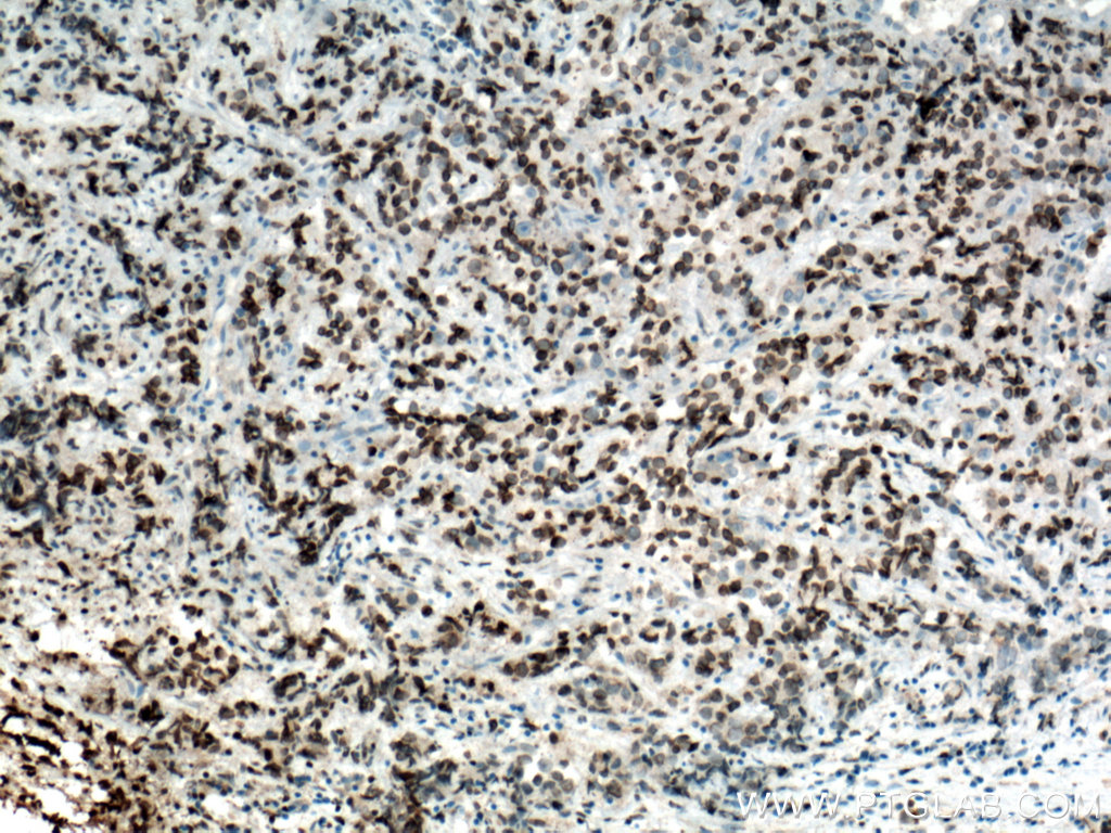 NUP62 Monoclonal antibody