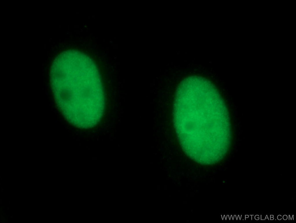 NSUN2 Monoclonal antibody