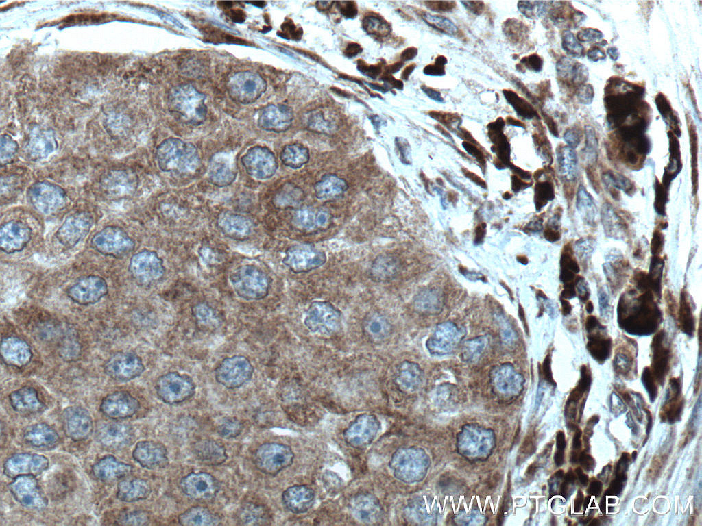 STT3A Monoclonal antibody