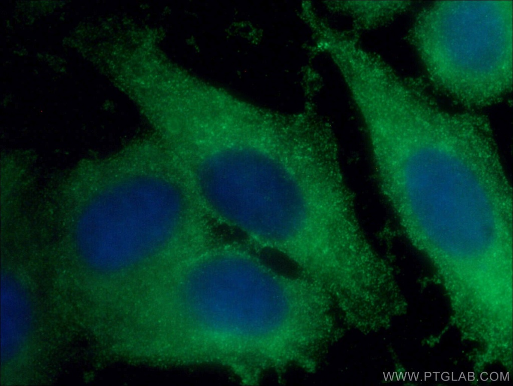 Beta Galactosidase Monoclonal antibody