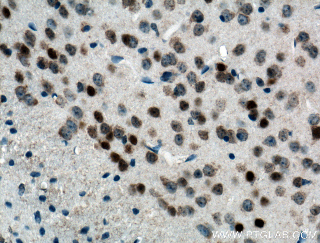 FOS Monoclonal antibody
