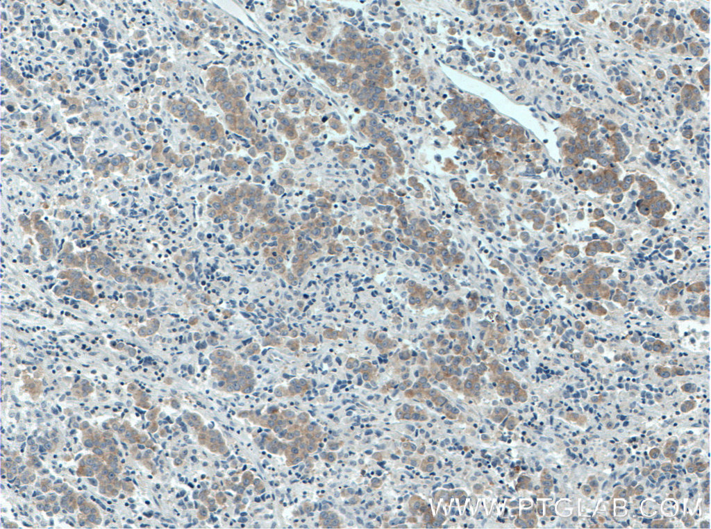 RAF1 Monoclonal antibody