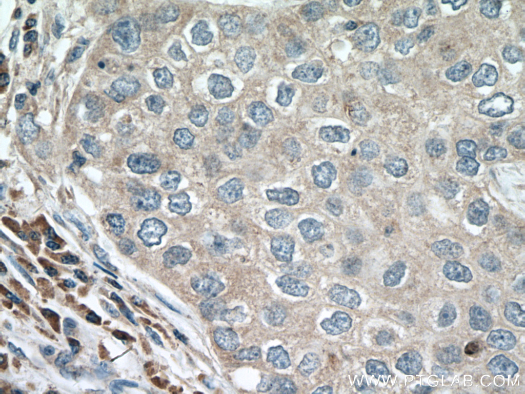 ACAP1 Monoclonal antibody