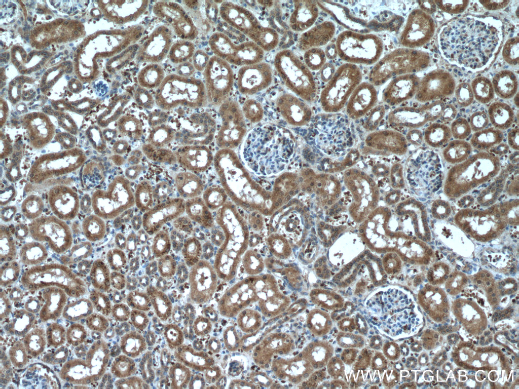 NXN Monoclonal antibody